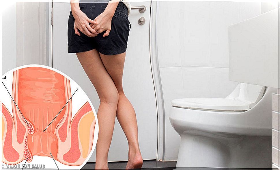 6 home and natural remedies against hemorrhoids