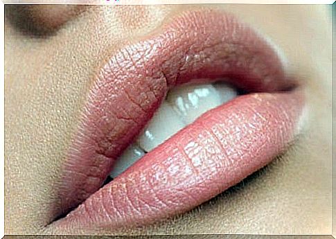 Dry lips