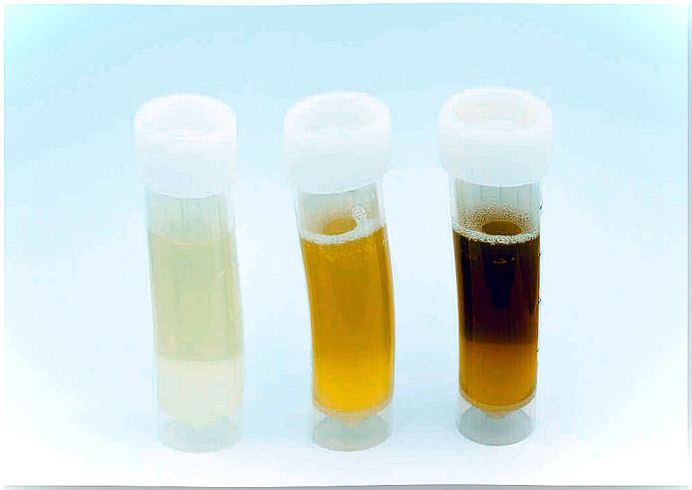 Different samples of light and dark urine.