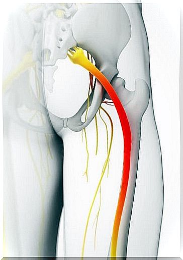 Sciatic nerve in people