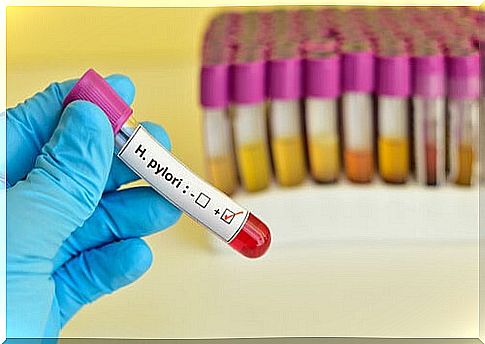 positive H. pylori test