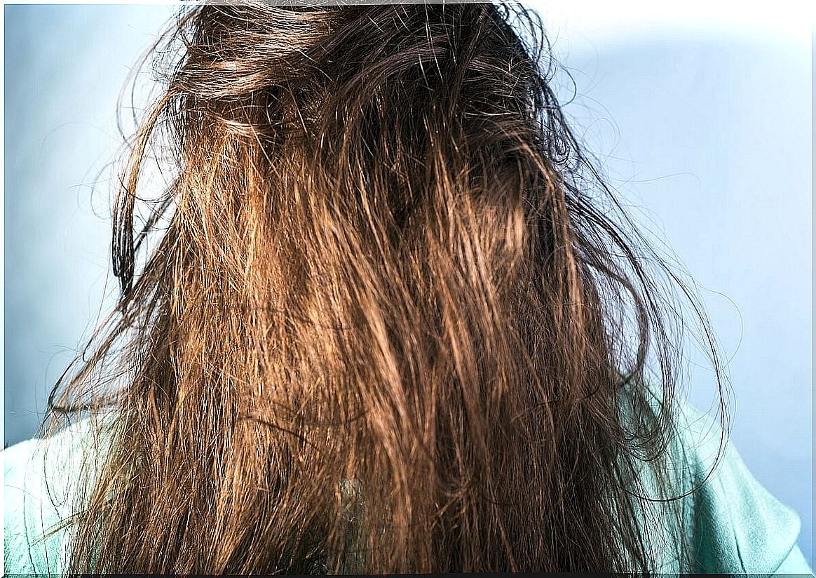 What are the causes of oily hair?