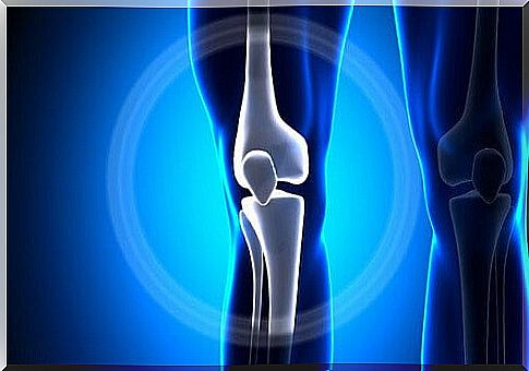 knee osteosarcoma