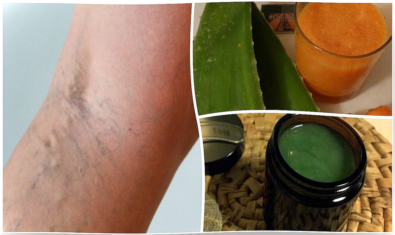 Relieve varicose veins with this old grandmother's recipe