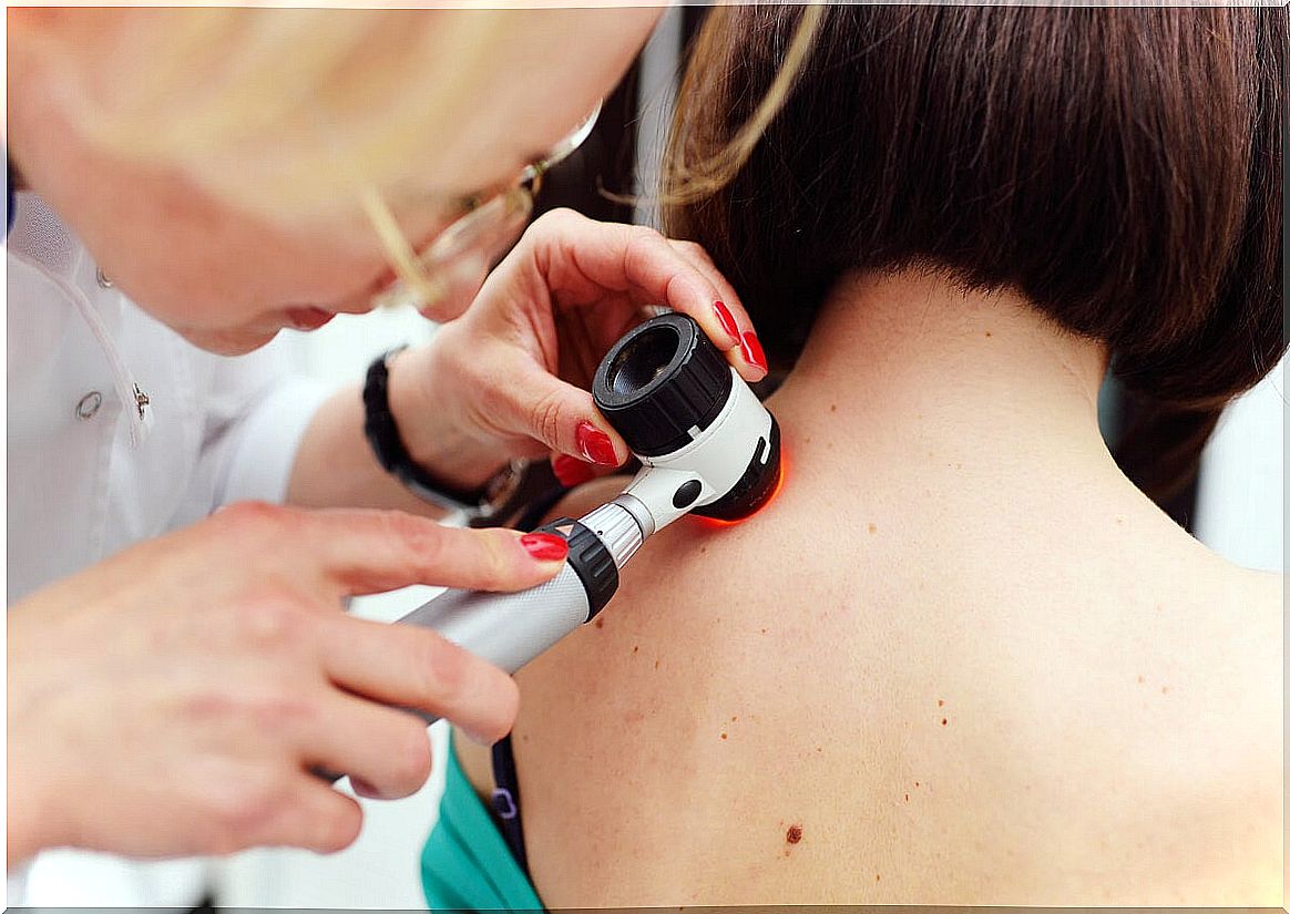 Skin tags: causes and risk factors