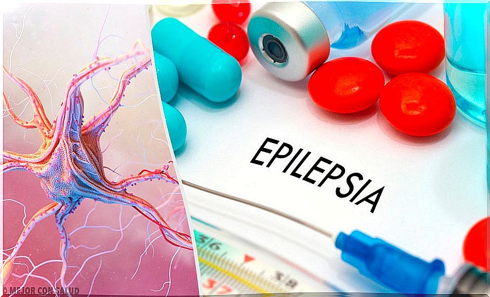 Vigabatrin in the treatment of epilepsy